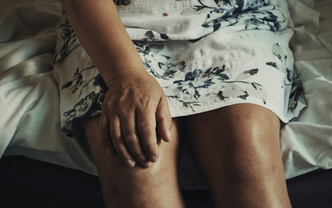 A Practical Guide to Knowing When Varicose Veins Need Care