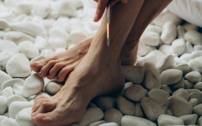 Can Varicose Veins Cause Restless Legs Syndrome?